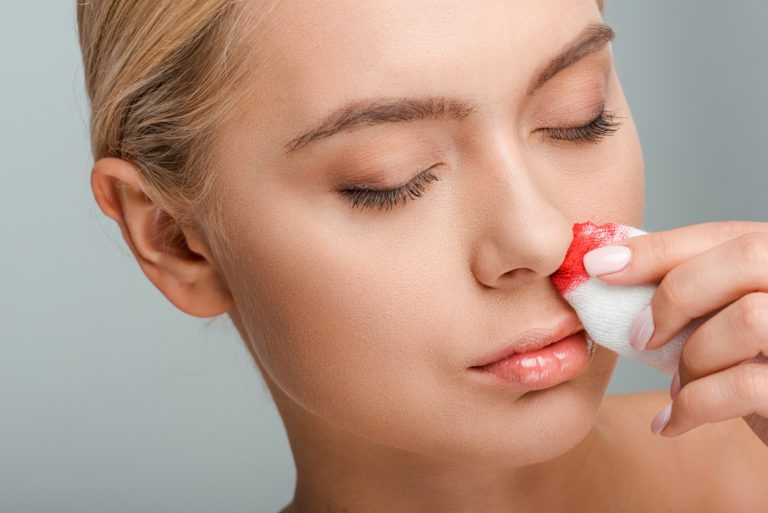 Nasenbluten unter Stress – Wie stoppst Du es?